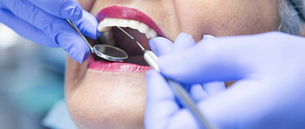 Best Emergency Tooth Extraction in Dry Ridge, KY